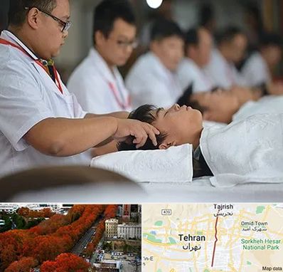 طب چینی در ولیعصر 