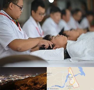 طب چینی در میناب