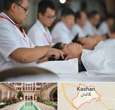 طب چینی در کاشان