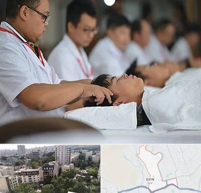 طب چینی در اوین