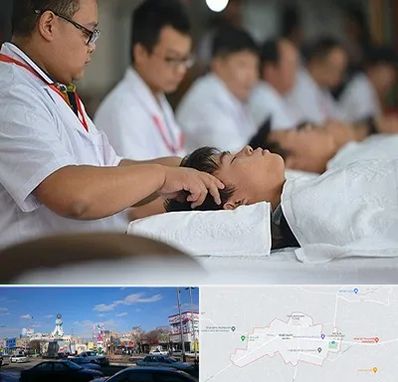 طب چینی در ماهدشت کرج 