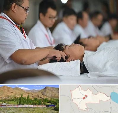 طب چینی در خاش