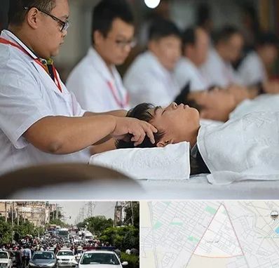 طب چینی در سیدی مشهد