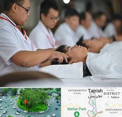 طب چینی در تجریش 