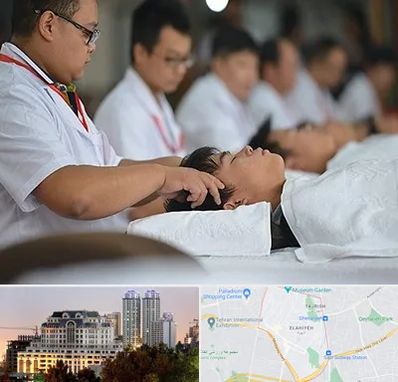 طب چینی در فرشته 