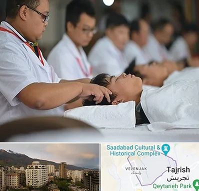 طب چینی در زعفرانیه 