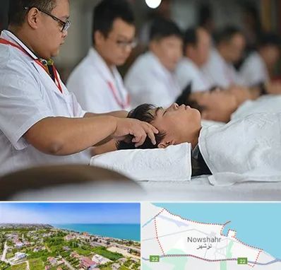 طب چینی در نوشهر