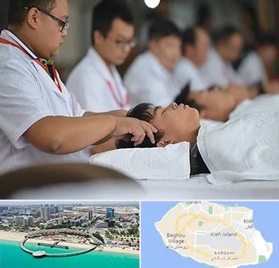 طب چینی در کیش