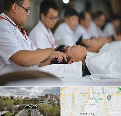 طب چینی در یوسف آباد 