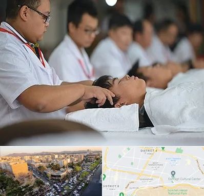 طب چینی در تهرانپارس 