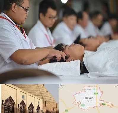 طب چینی در ساوه