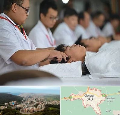 طب چینی در گرگان