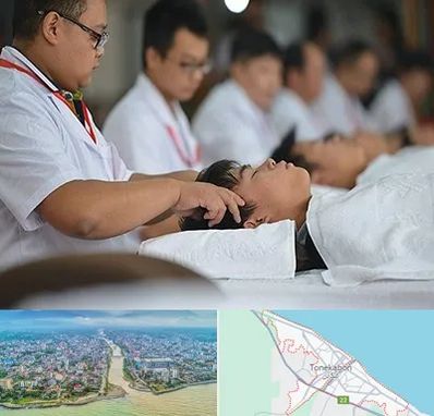 طب چینی در تنکابن