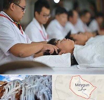 طب چینی در میگون
