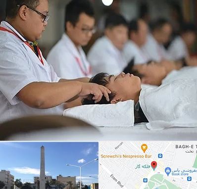 طب چینی در فلکه گاز شیراز 