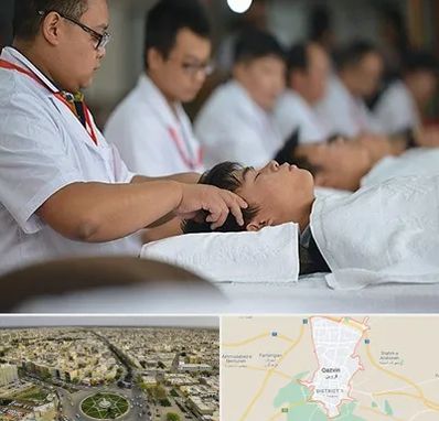 طب چینی در قزوین