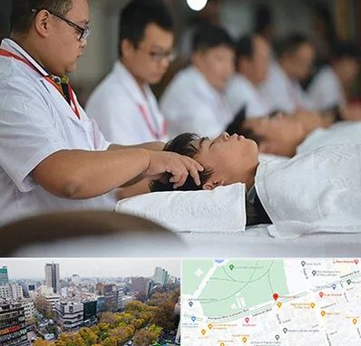 طب چینی در بلوار کشاورز 