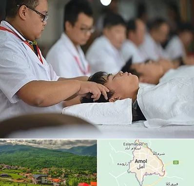 طب چینی در آمل