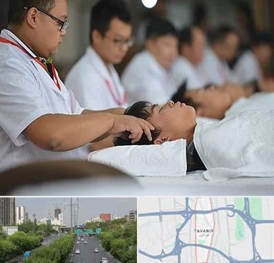 طب چینی در توانیر