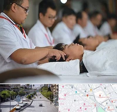 طب چینی در خیابان زند شیراز 