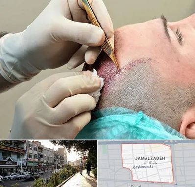 اسکالپ موی سر در خیابان جمالزاده