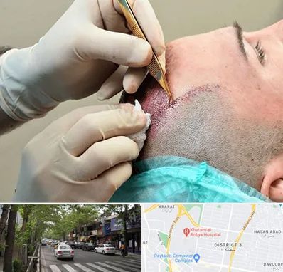 اسکالپ موی سر در ظفر 