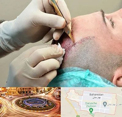 اسکالپ موی سر در بهارستان