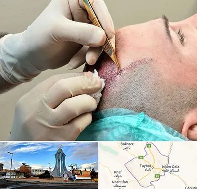 اسکالپ موی سر در تایباد