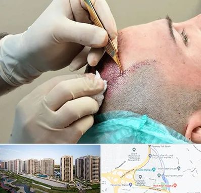 اسکالپ موی سر در المپیک 