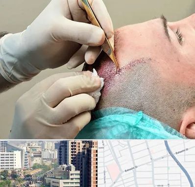 اسکالپ موی سر در خیابان بهشتی