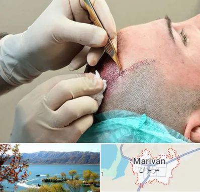 اسکالپ موی سر در مریوان