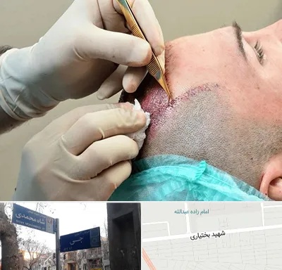 اسکالپ موی سر در سی متری جی