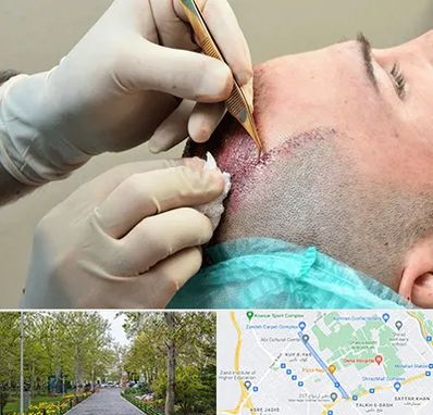 اسکالپ موی سر در قدوسی غربی شیراز 