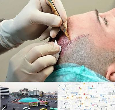 اسکالپ موی سر در میدان انقلاب 