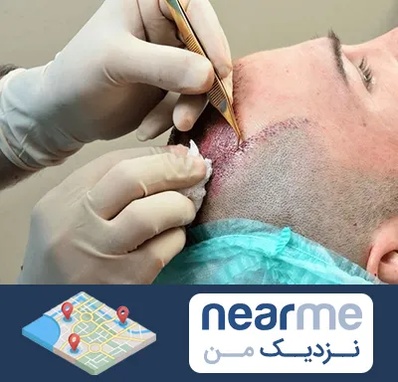 اسکالپ موی سر در نزدیک من