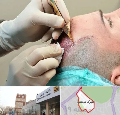 اسکالپ موی سر در شهرک شریعتی