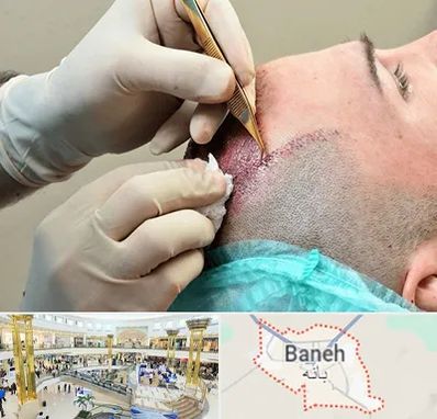 اسکالپ موی سر در بانه