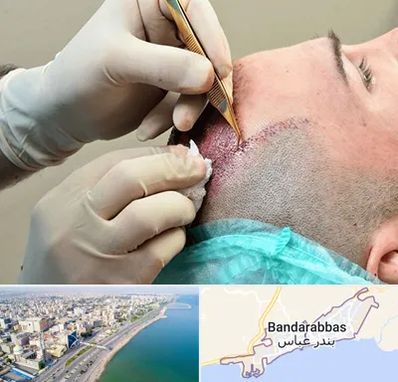 اسکالپ موی سر در بندرعباس