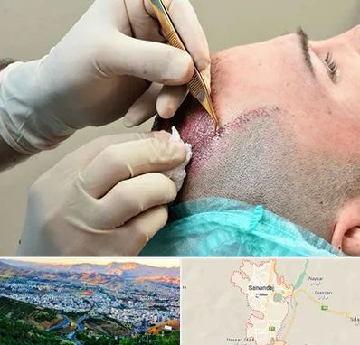 اسکالپ موی سر در سنندج