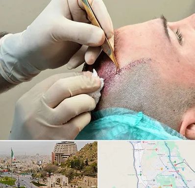 اسکالپ موی سر در فرهنگ شهر شیراز 