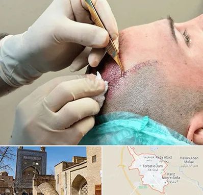 اسکالپ موی سر در تربت جام