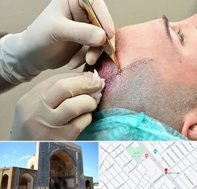 اسکالپ موی سر در مصلی مشهد