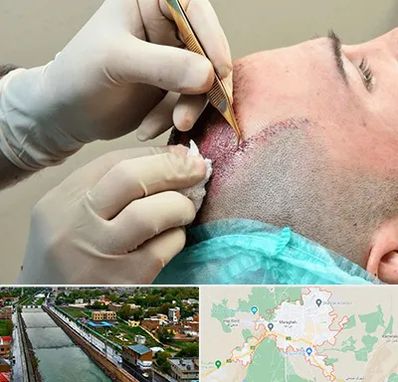 اسکالپ موی سر در مراغه