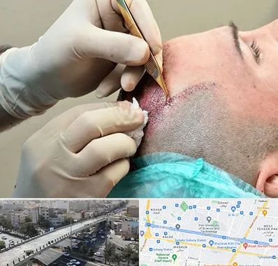 اسکالپ موی سر در فرجام 