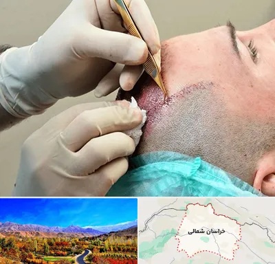 اسکالپ موی سر در خراسان شمالی
