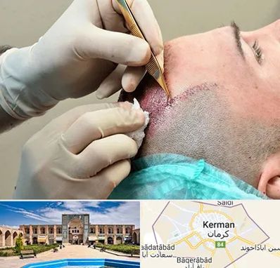 اسکالپ موی سر در کرمان