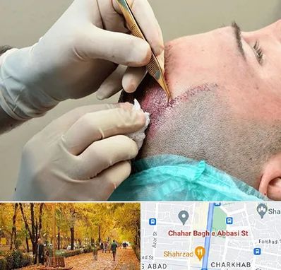 اسکالپ موی سر در چهارباغ اصفهان 