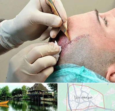 اسکالپ موی سر در صومعه سرا