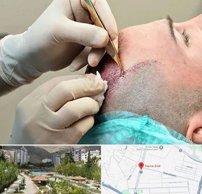 اسکالپ موی سر در بلوار تعاون