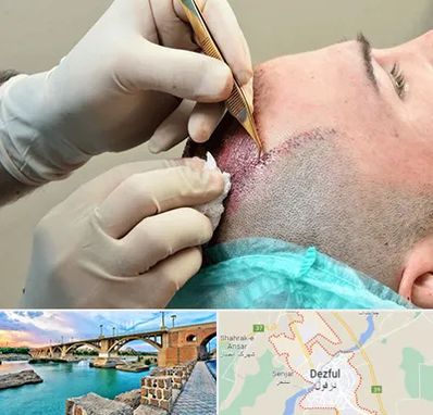 اسکالپ موی سر در دزفول